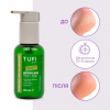 Ремувер для педикюру TUFI profi BioPeeling Fruit Acid для розм'якшення огрубілої шкіри стоп кислотний, 100 мл - фото №3
