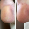 Крем от трещин для рук и стоп из жожоба Resultum Anti Crack Cream Jojoba, 25 мл - фото №5 Крем от трещин для рук и стоп из жожоба Resultum Anti Crack Cream Jojoba, 25 мл - фото №5