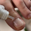 Олія від оніхолізису та грибка Resultum Onistopix Oil, 15 мл - фото №3