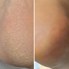 Крем від тріщин для рук та стоп з лемонграсом Resultum Regenerix Cream, 25 мл - фото №4